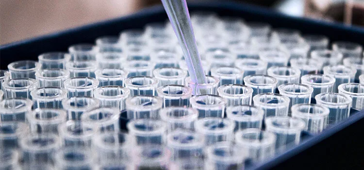 Скидка 15% на стандартное обследование мужчин на ЗППП