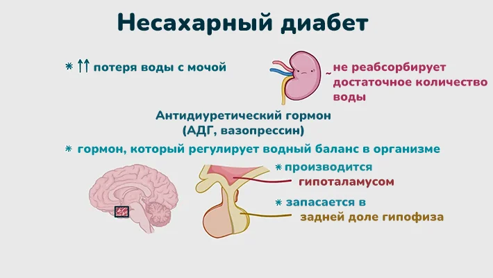Несахарный диабет