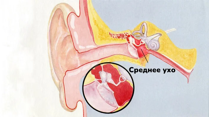 Травмы среднего уха