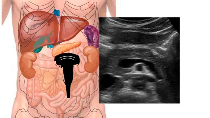 Что показывает УЗИ поджелудочной железы