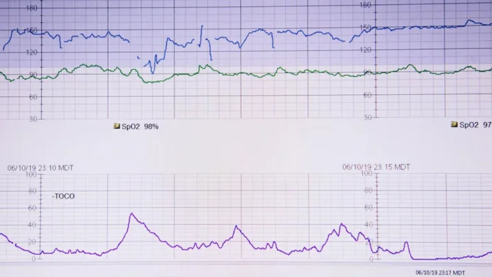 Что показывает КТГ плода