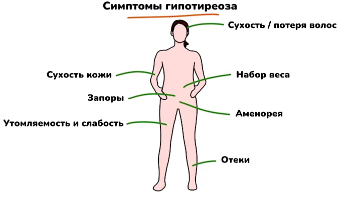 Симптомы гипотиреоза