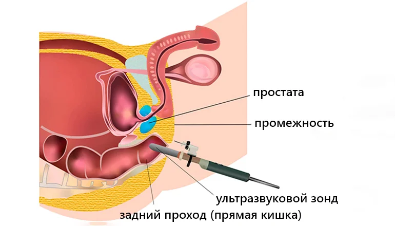 Подготовка к УЗИ предстательной железы