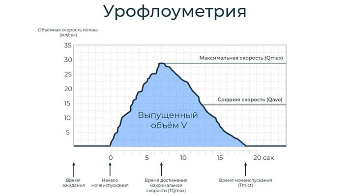 График урофлоуметрии