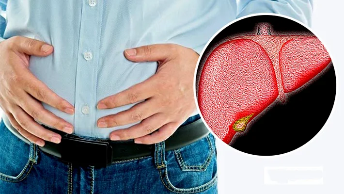 Вздутие живота при циррозе печени