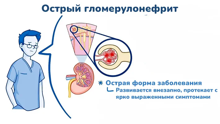 Симптомы острого гломерулонефрита