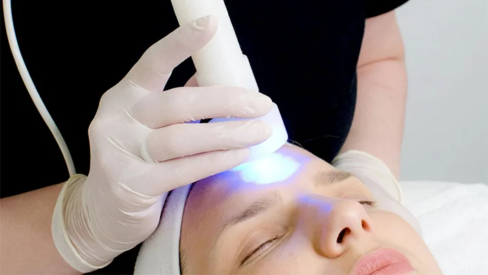 Фототерапия акне