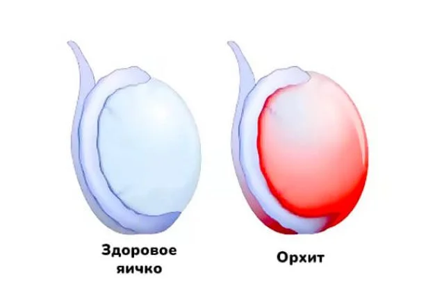 Орхит