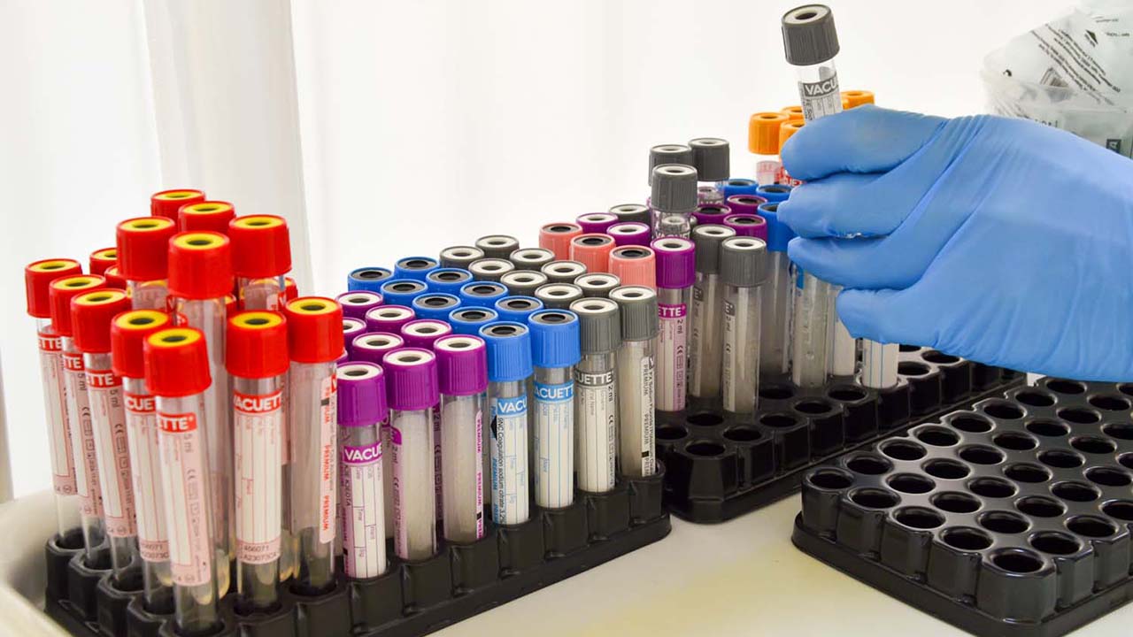 Штатив с пробирками для анализов крови