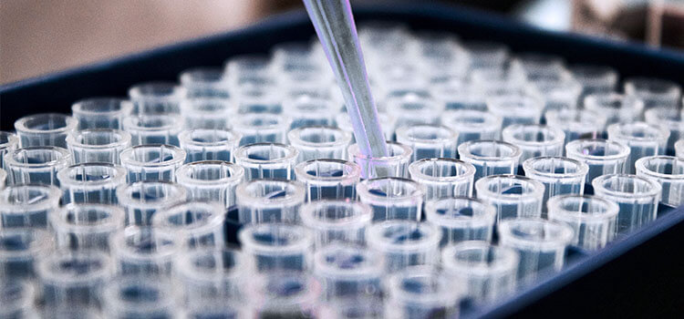 Скидка 15% на стандартное обследование мужчин на ЗППП