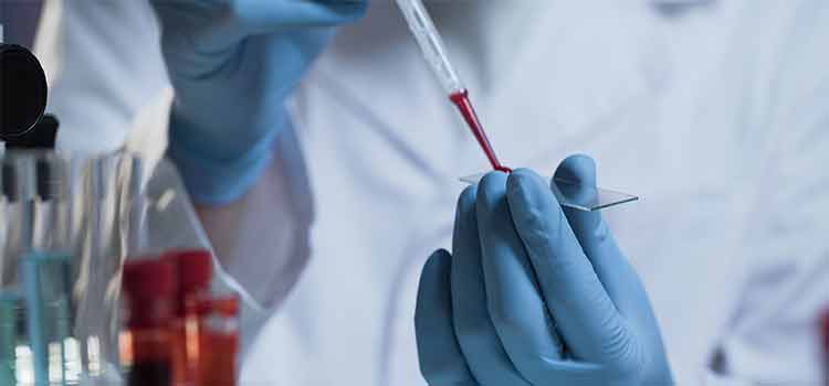 Скидка на все анализы крови 15% по кодовому слову