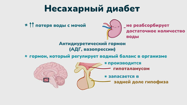 Несахарный диабет