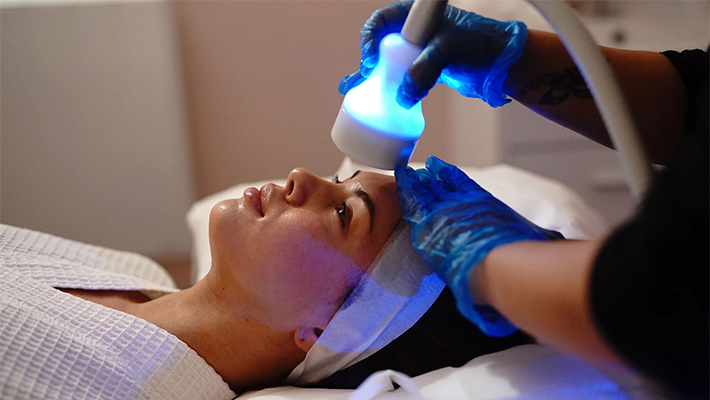 Криотерапия акне