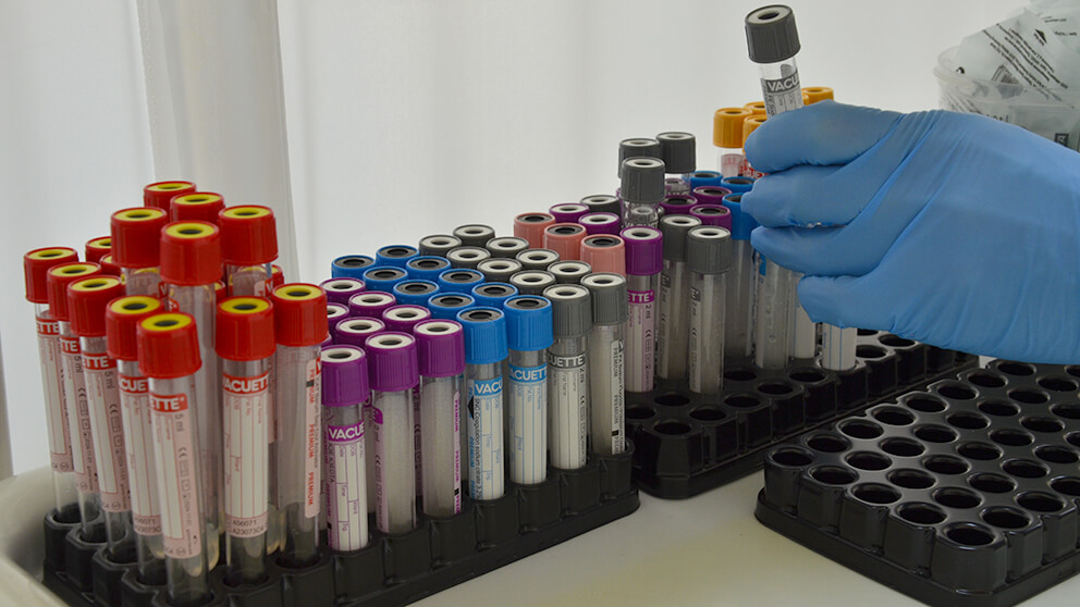 Анализы крови на гормоны щитовидной железы