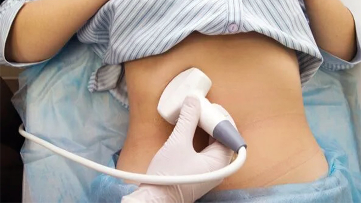 УЗИ печени на дому