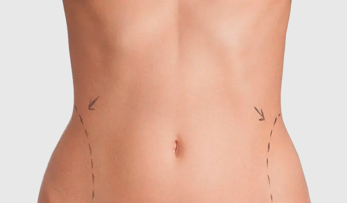 Асимметрия живота у женщины справа или слева