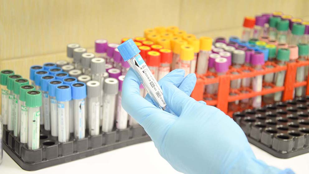 Пренатальная диагностика