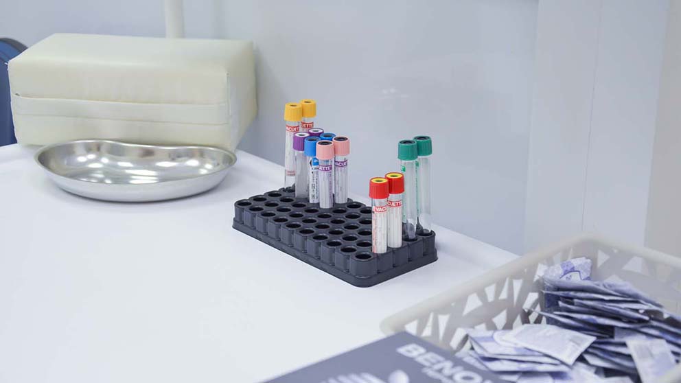 Анализы крови на мужские половые гормоны