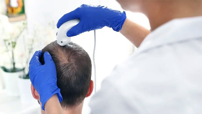 Что такое трихоскопия