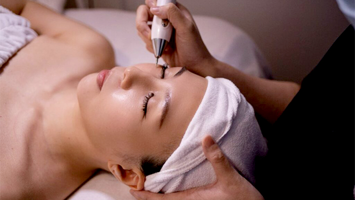 Лазерное удаление милиумов