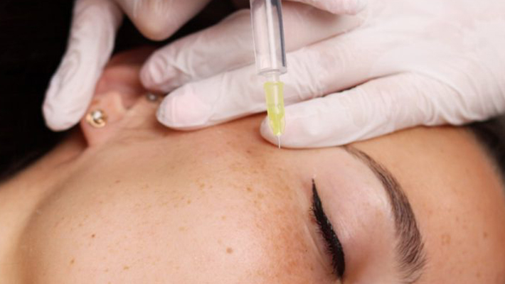 Биоревитализация кожи вокруг глаз