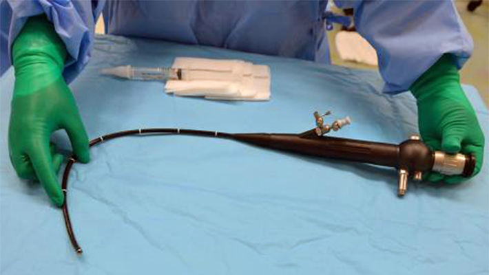 Что такое цистоскопия