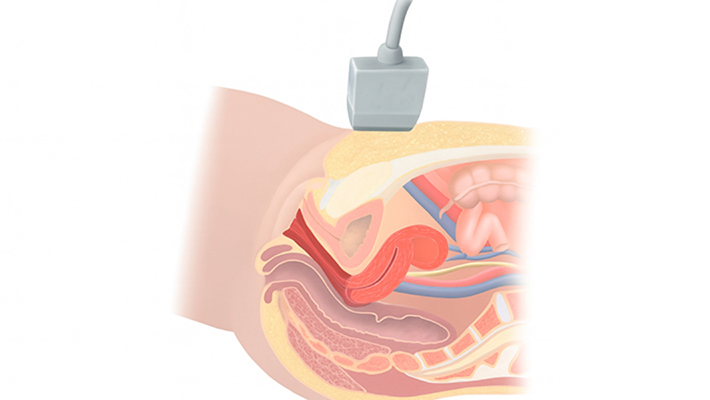 Подготовка к УЗИ матки и придатков