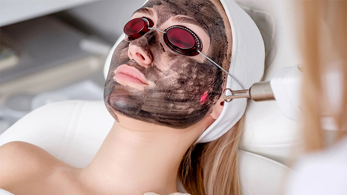 Карбоновый пилинг лица