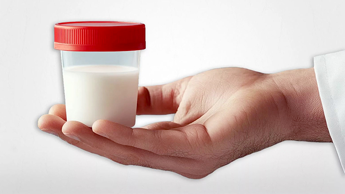 Как сдают спермограмму мужчины