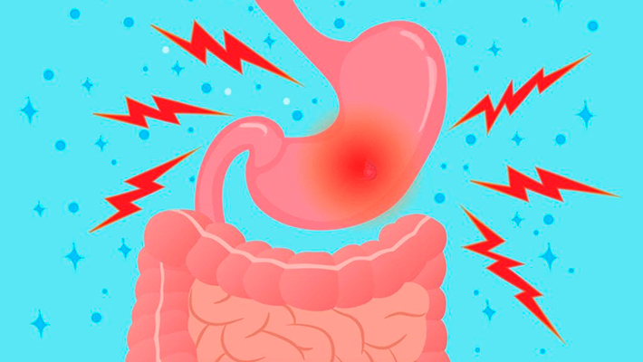 Схваткообразные боли в животе 