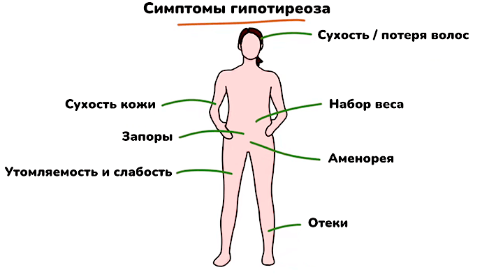 Симптомы гипотиреоза