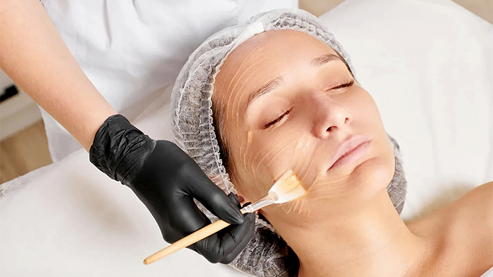 Гликолевый пилинг для лица