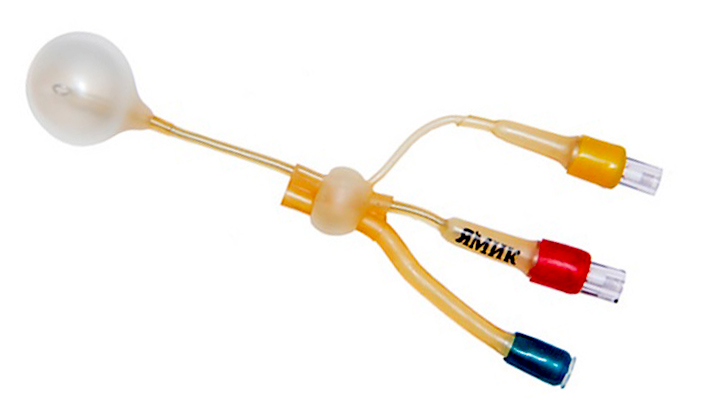 Санация околоносовых пазух с использованием ЯМИК–катетера