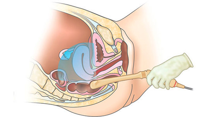 Правильная подготовка к ТРУЗИ