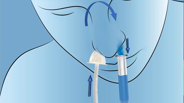 Промывание носа через соустье