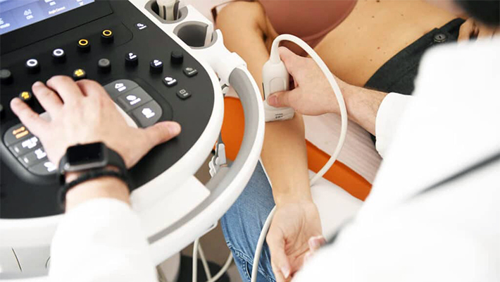 УЗИ сосудов верхних конечностей