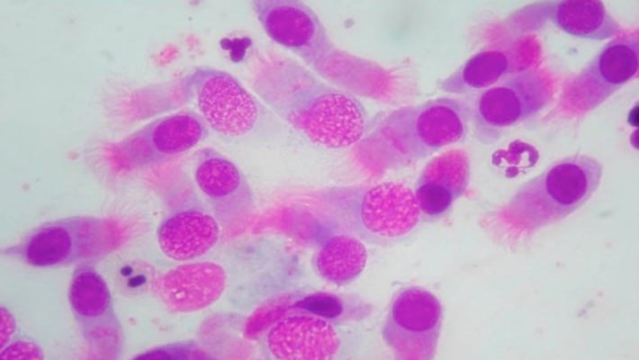 Риноцитограмма