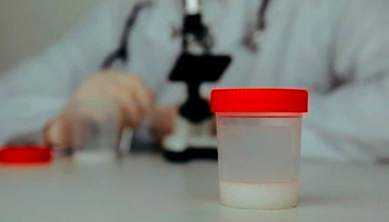 МАР-тест для мужчин: что это такое и зачем нужен