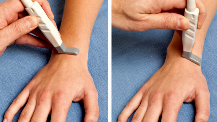 УЗИ кисти руки