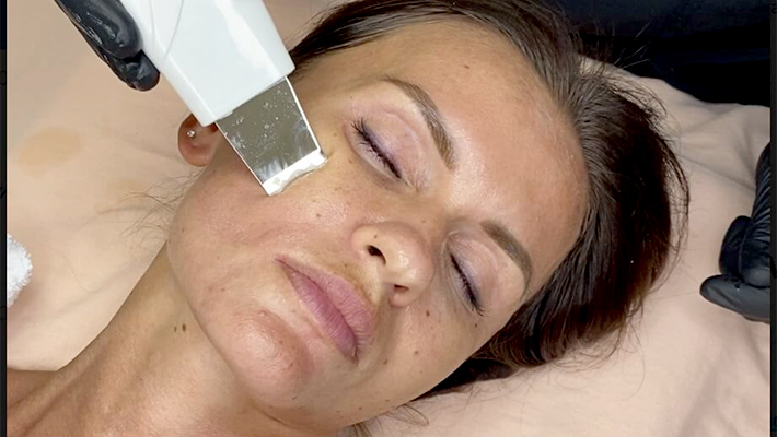 Все об ультразвуковой чистке лица