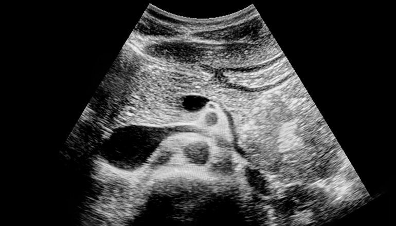 Подготовка к УЗИ поджелудочной железы