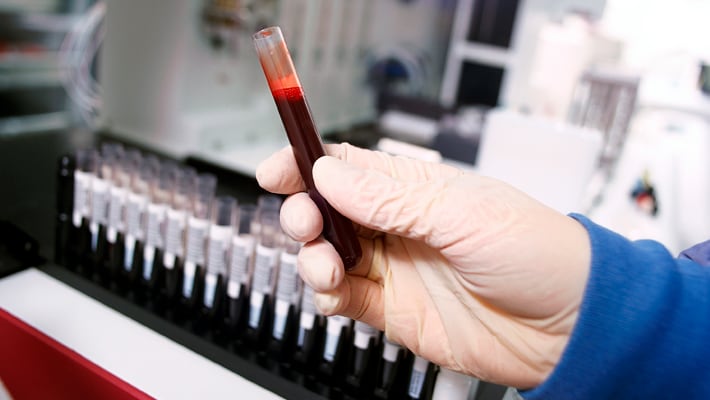 Анализ крови на микроэлементы