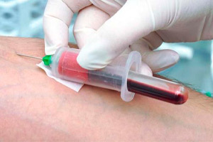 Как берут кровь и проводят анализ крови на гормоны щитовидной железы