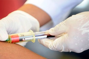 Как проводится анализ крови на инфекции
