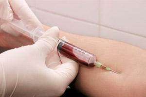 Как сдается и проводится анализ крови на Т4
