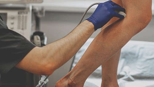 Правильная подготовка к УЗИ вен нижних конечностей