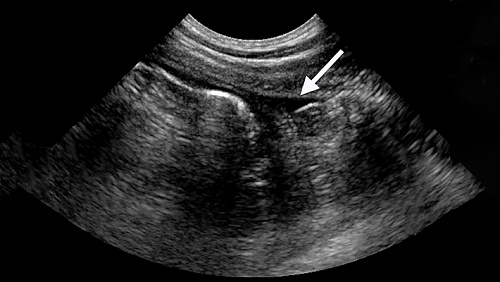 УЗИ забрюшинного пространства: что входит в исследование?