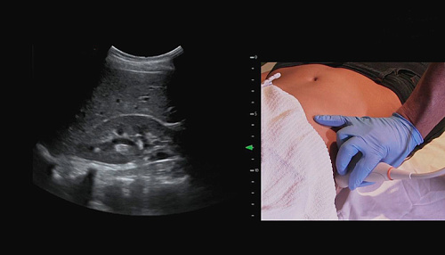 Подготовка к УЗИ желчного пузыря