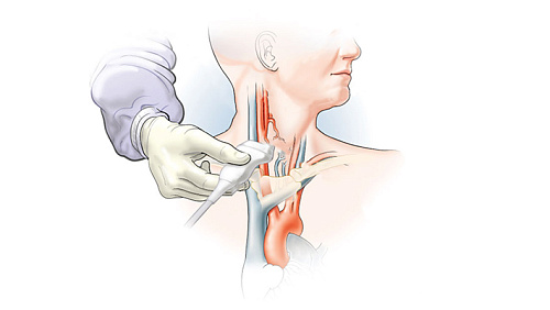Что показывает УЗИ сосудов головного мозга